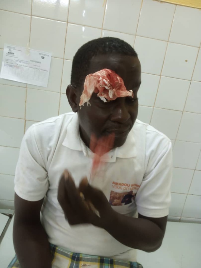 Crise au Rhdp/ Un ministre et un député à couteaux tirés : des militants molestés, blessés, des portables arrachés. Crise au Rhdp/ Un ministre et un député à couteaux tirés : des militants molestés, blessés, des portables arrachés.