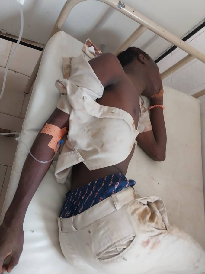 L'un des élèves souffrant de nombreuses contusions L'un des élèves souffrant de nombreuses contusions