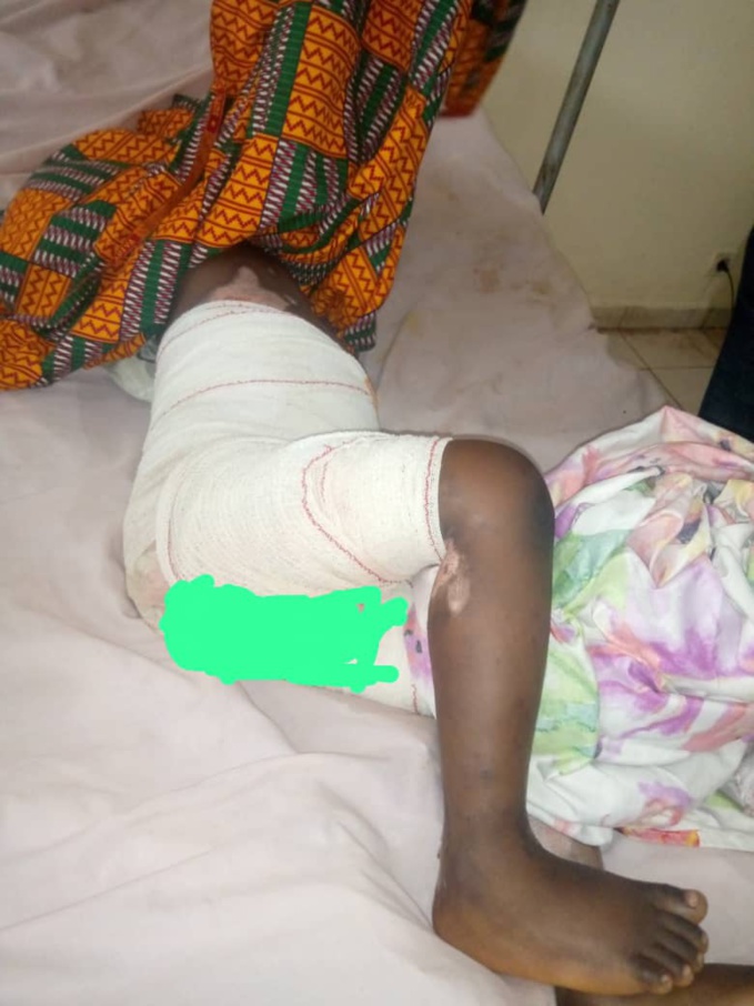 Grand Lahou/ Un gamin trébuche et atterrit dans la sauce Grand Lahou/ Un gamin trébuche et atterrit dans la sauce