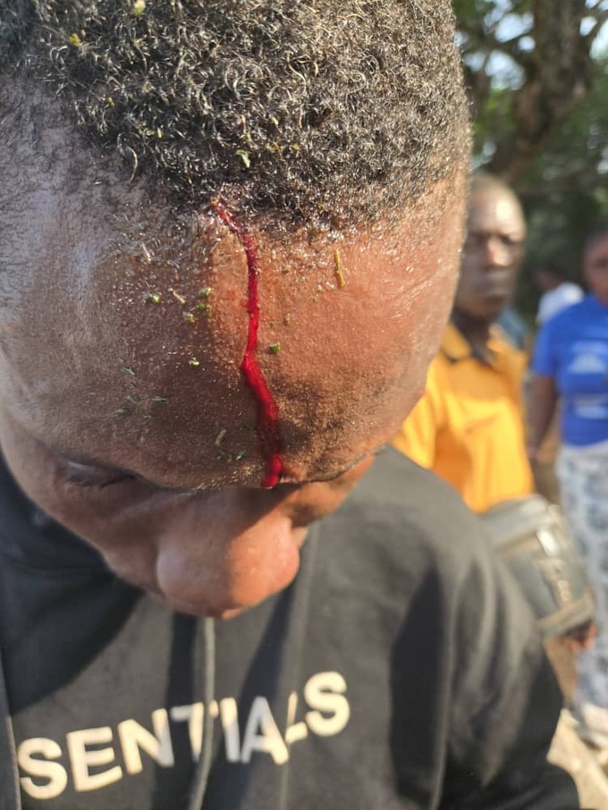 Un militant blessé à Zou dans le département de Bangolo Un militant blessé à Zou dans le département de Bangolo