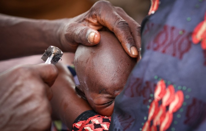 L'excision, une pratique aux conséquences tragiques