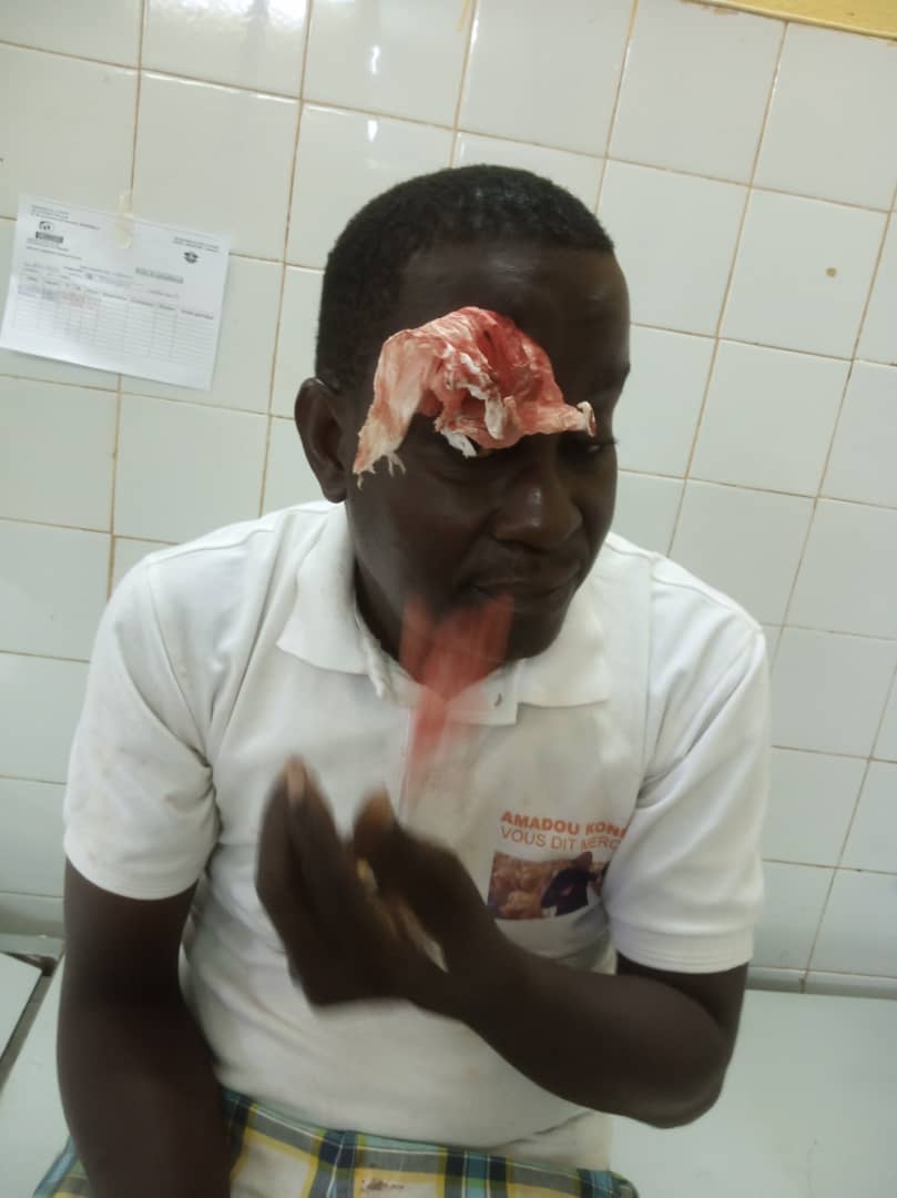 Crise au Rhdp/ Un ministre et un député à couteaux tirés : des militants molestés, blessés, des portables arrachés. Crise au Rhdp/ Un ministre et un député à couteaux tirés : des militants molestés, blessés, des portables arrachés.