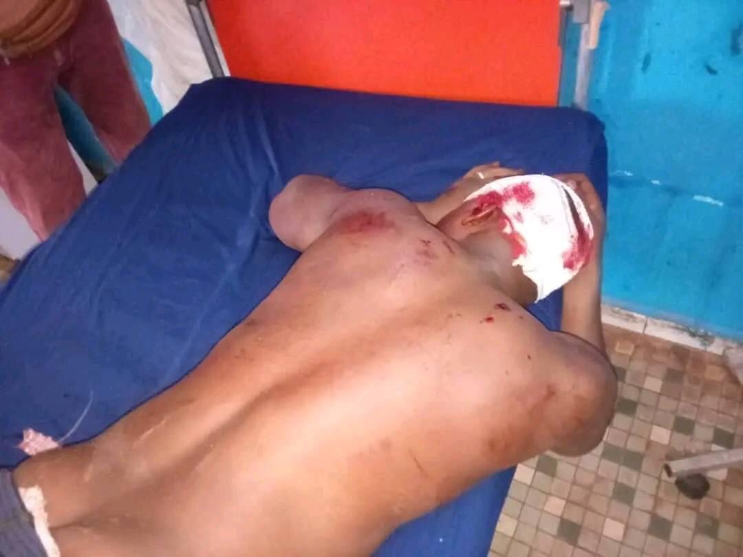 Drame à N'Guinou : Un Gendarme tue un jeune homme accidentellement