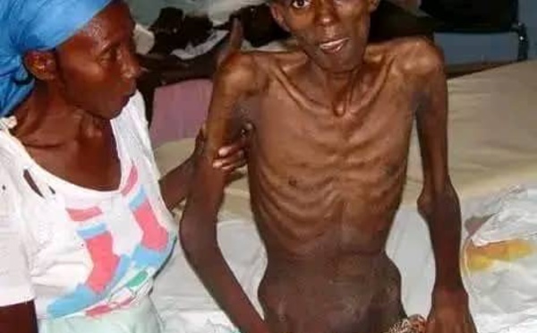 Bouaké/ Une maladie mystérieuse fait des ravages dans un village : Déjà 5 morts et plusieurs contaminés.